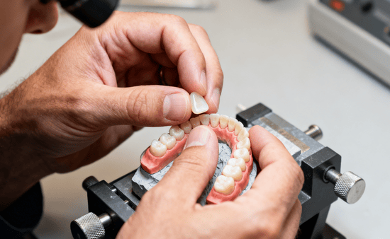 Fillings For Minor Cavities