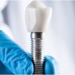 Importance of Choosing Skilled Dentists for Safe Dental Implant Procedures in Winnipeg